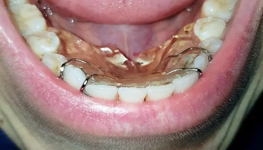 Dispositivo Eliba indossato