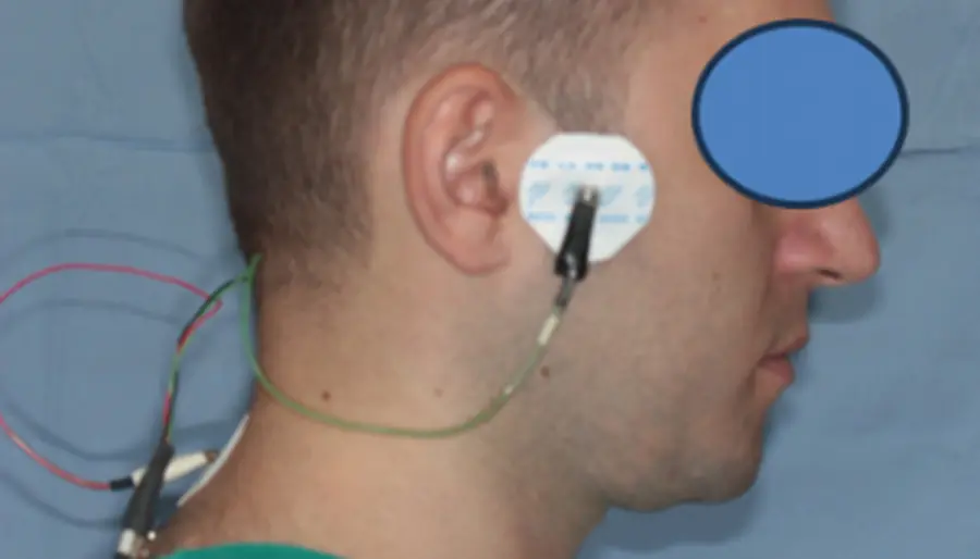 Stimolazione ULF-TENS